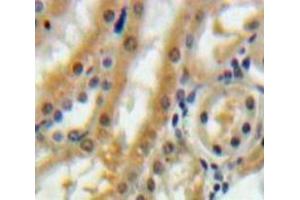 Image no. 2 for anti-Betacellulin (BTC) (AA 32-118) antibody (ABIN1077860)