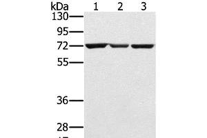 Western Blot analysis of Hepg2, A172 and Raji cell using SLC25A13 Polyclonal Antibody at dilution of 1:450
