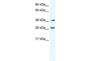 Image no. 1 for anti-Myocyte Enhancer Factor 2B (MEF2B) (C-Term) antibody (ABIN925826)