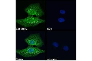 Image no. 3 for anti-Lipin 2 (LPIN2) (C-Term) antibody (ABIN185361)