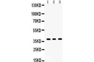 Image no. 1 for anti-Sirtuin 6 (SIRT6) (AA 14-180) antibody (ABIN3043435)