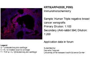 Image no. 4 for anti-Keratin 8 (KRT8) (N-Term) antibody (ABIN2777112)