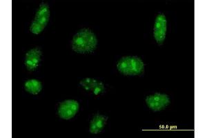 Image no. 3 for anti-Exosome Component 5 (EXOSC5) (AA 1-235) antibody (ABIN528001)