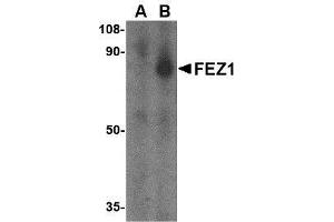 Image no. 1 for anti-Fasciculation and Elongation Protein zeta 1 (Zygin I) (FEZ1) (C-Term) antibody (ABIN499830)