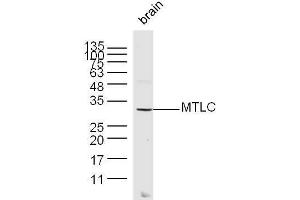 Image no. 2 for anti-Myc Target 1 (MYCT1) (AA 21-100) antibody (ABIN728015)
