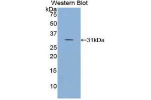 Image no. 1 for anti-Inhibitor of KB Kinase beta Interacting Protein (IKbIP) (AA 80-315) antibody (ABIN1859321)
