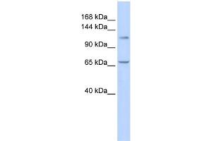 Image no. 1 for anti-Zinc Finger and BTB Domain-Containing Protein 10 (ZBTB10) (Middle Region) antibody (ABIN2774995)