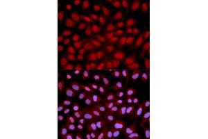 Image no. 2 for anti-Nuclear Factor of Activated T-Cells, Cytoplasmic, Calcineurin-Dependent 1 (NFATC1) antibody (ABIN3022101)
