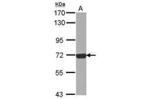 Image no. 2 for anti-Complement Component C9 (C9) (Internal Region) antibody (ABIN1496002)