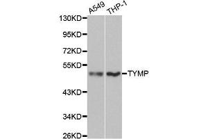 Thymidine Phosphorylase 抗体  (AA 1-200)