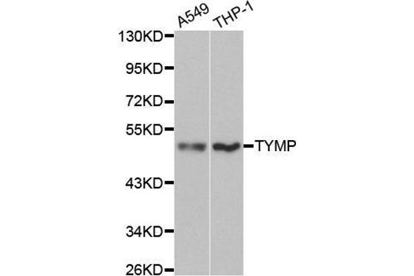 Thymidine Phosphorylase anticorps  (AA 1-200)