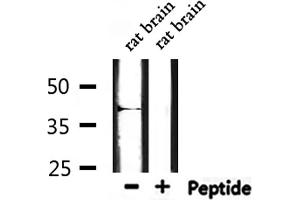 Image no. 1 for anti-Mitochondrially Encoded Cytochrome B (MT-CYB) (N-Term) antibody (ABIN6259564)