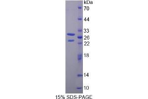 Image no. 1 for BMX Non-Receptor Tyrosine Kinase (BMX) (AA 287-523) protein (His tag) (ABIN6238216)