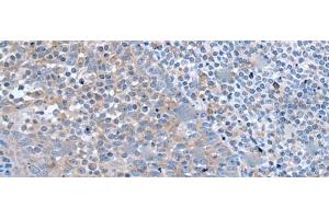 Immunohistochemistry of paraffin-embedded Human tonsil tissue using ZIC1 Polyclonal Antibody at dilution of 1:65(x200)