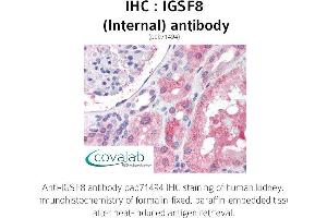 Image no. 2 for anti-Immunoglobulin Superfamily, Member 8 (IGSF8) (Internal Region) antibody (ABIN1735837)