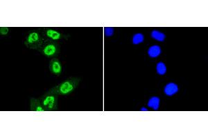 Image no. 3 for anti-Signal Transducer and Activator of Transcription 3 (Acute-Phase Response Factor) (STAT3) (pSer727) antibody (ABIN5557530)