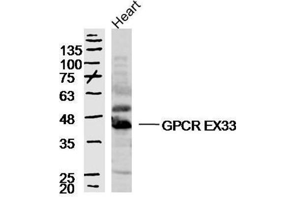 anti-G Protein-Coupled Receptor 84 (GPR84) (AA 21-120) antibody