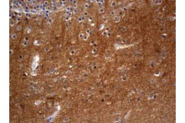 VSNL1 antibody  (AA 2-191)