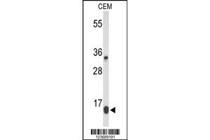 Western Blotting (WB) image for anti-DIRAS Family, GTP-Binding RAS-Like 1 (DIRAS1) antibody (ABIN2158554)