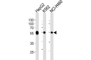 Image no. 6 for anti-Aldehyde Dehydrogenase 1 Family, Member A1 (ALDH1A1) antibody (ABIN659020)