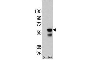 Image no. 6 for anti-PTEN Induced Putative Kinase 1 (PINK1) antibody (ABIN3032404)