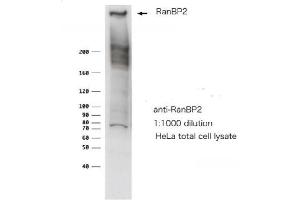 RANBP2 antibody