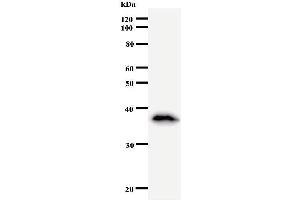 Image no. 2 for anti-Matrin 3 (MATR3) antibody (ABIN933126)