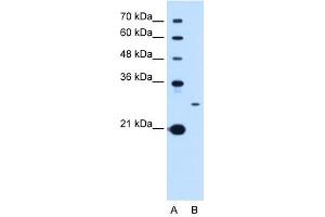 Image no. 1 for anti-Tetraspanin 15 (TSPAN15) (C-Term) antibody (ABIN635763)