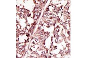 Image no. 2 for anti-C-Ros Oncogene 1 , Receptor tyrosine Kinase (ROS1) (AA 33-63), (N-Term) antibody (ABIN359936)