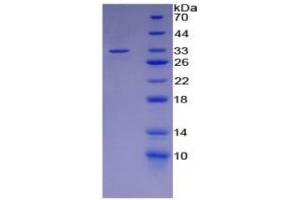 Image no. 4 for Lipopolysaccharide Binding Protein (LBP) ELISA Kit (ABIN6574276)