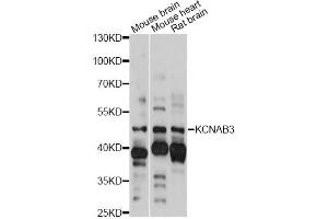 Image no. 1 for anti-Potassium Voltage-Gated Channel, Shaker-Related Subfamily, beta Member 3 (KCNAB3) antibody (ABIN6292720)