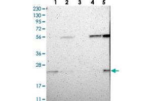 Image no. 2 for anti-Chromosome 1 Open Reading Frame 93 (C1orf93) antibody (ABIN5577823)