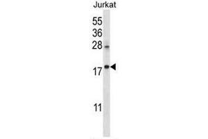 Image no. 1 for anti-Keratin Associated Protein 25-1 (KRTAP25-1) (AA 80-110), (C-Term) antibody (ABIN953120)