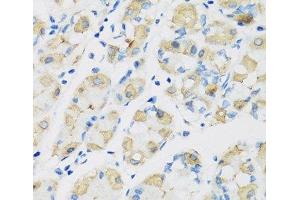 Immunohistochemistry of paraffin-embedded Human stomach using ATP4B Polyclonal Antibody at dilution of 1:100 (40x lens).
