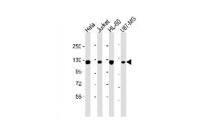 Image no. 1 for anti-Ring Finger Protein 20 (RNF20) antibody (ABIN4913698)