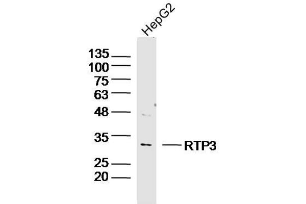 anti-Receptor (Chemosensory) Transporter Protein 3 (RTP3) (AA 21-120) antibody