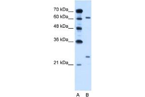 Image no. 1 for anti-RAR-Related Orphan Receptor A (RORA) (Middle Region) antibody (ABIN2782272)