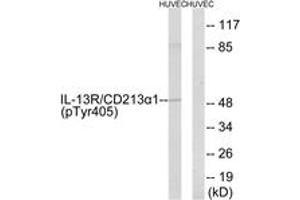 Western blot analysis of extracts from HuvEc cells treated with serum 20% 15', using IL-13R alpha1 (Phospho-Tyr405) Antibody.