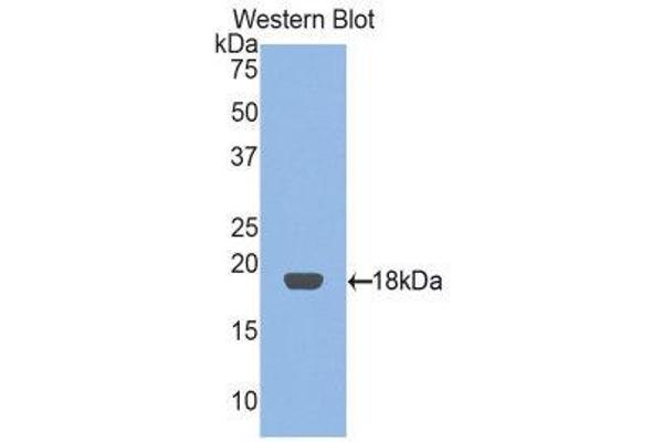 anti-Retinol Binding Protein 2, Cellular (RBP2) (AA 1-134) antibody