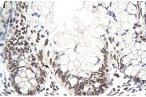 Rabbit Anti-ZNF394 Antibody Catalog Number: ARP30072 Paraffin Embedded Tissue: Human Intestine Cellular Data: Epithelial cells of intestinal villas Antibody Concentration: 4.