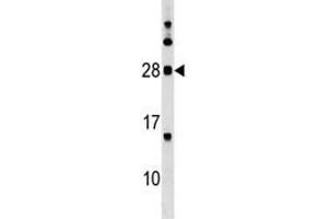 MOG antibody western blot analysis in K562 lysate.