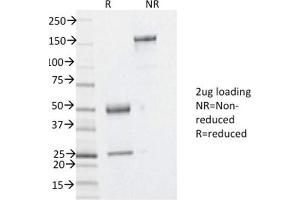Image no. 1 for anti-Y Box Binding Protein 1 (YBX1) antibody (ABIN6940225)