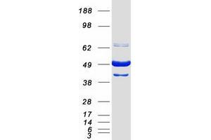 Image no. 1 for BCL2-Associated Athanogene 5 (BAG5) (Transcript Variant 2) protein (Myc-DYKDDDDK Tag) (ABIN2715137)