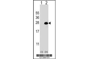 Western Blotting (WB) image for anti-DiGeorge Syndrome Critical Region Gene 6-Like (DGCR6L) (Center) antibody (ABIN2160567)