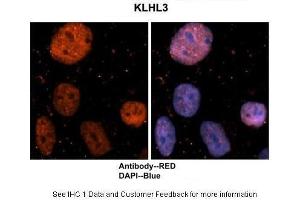 Image no. 1 for anti-Kelch-Like 3 (KLHL3) (N-Term) antibody (ABIN2775874)