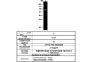 Image no. 2 for anti-Legumain (LGMN) (AA 18-435) antibody (ABIN6924085)