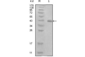 Image no. 1 for anti-Human Papillomavirus 16 Transforming Protein E7 (HPV16 E7) antibody (ABIN1847175)