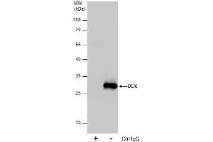 Image no. 3 for anti-Deoxycytidine Kinase (DCK) (Center) antibody (ABIN2856517)
