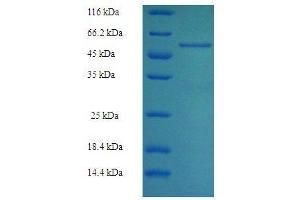 SDS-PAGE of protein expressed in E.