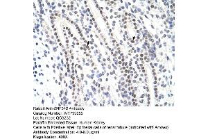 Image no. 1 for anti-Zinc Finger Protein 296 (ZNF296) (C-Term) antibody (ABIN2778483)
